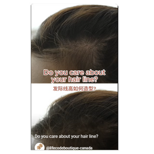 Do You care about your hair line ?